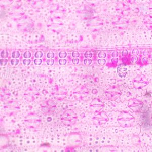 soro-de-marchantia-sec