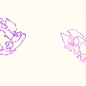 CROMOSOMAS GIGANTES DE GLANDULA SALIVAL, M.E. Marca Zuzi.