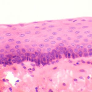 EPITELIO ESTRATIFICADO PLANO, SEC. Marca Zuzi.