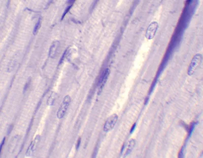 MUSCULO CARDIACO (ESTRIADO), SEC. Marca Zuzi.