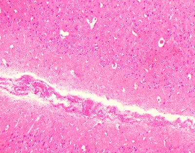 CEREBRO CONEJO, TINCION PLATA, SEC. Marca Zuzi.