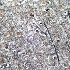CEREBRO HUMANO, TINCION PLATA, SEC. Marca Zuzi.