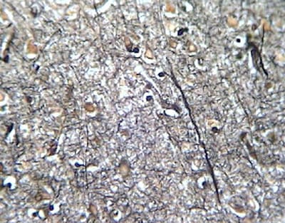 CEREBRO HUMANO, TINCION PLATA, SEC. Marca Zuzi.