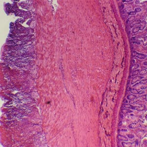 INTESTINO DELGADO, S.T. Marca Zuzi.