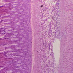INTESTINO GRUESO, S.T. Marca Zuzi.