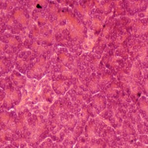 PANCREAS, SEC. Marca Zuzi.