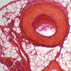 ARTERIA Y VENA, S.T. Marca Zuzi.