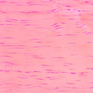 TENDON, TEJIDO CONJUNTIVO DENSO, S.L. Marca Zuzi.