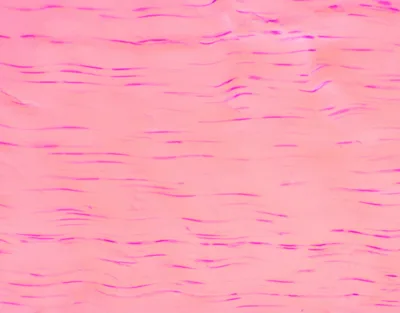 TENDON, TEJIDO CONJUNTIVO DENSO, S.L. Marca Zuzi.