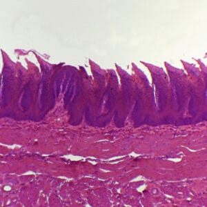 LENGUA CON PAPILAS FILIFORMES, S.L. Marca Zuzi.
