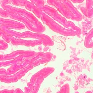 INTESTINO GRUESO DE RANA, S.T. Marca Zuzi.
