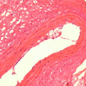 ARTERIA DE RANA, S.T. Marca Zuzi.