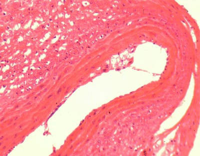 ARTERIA DE RANA, S.T. Marca Zuzi.