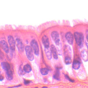 EPITELIO CILIADO, SEC. Marca Zuzi.