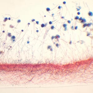 ASPERGILLUS, M.E. Marca Zuzi.