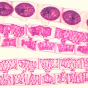 CONJUGACION DE SPIROGYRA, M.E. Marca Zuzi.