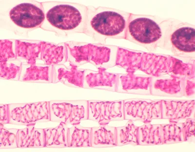 CONJUGACION DE SPIROGYRA, M.E. Marca Zuzi.