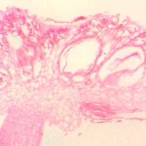 ANTERIDIO DE MARCHANTIA, S.L. Marca Zuzi.