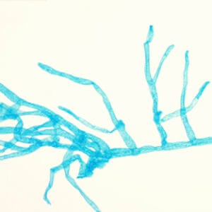 PROTONEMA DE MUSGO, M.E. Marca Zuzi.