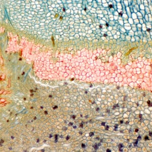 PECIOLO DE MORUS ALBA, CAPA ABSCISION, S.L. Marca Zuzi.