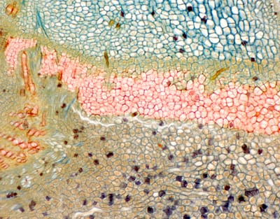 PECIOLO DE MORUS ALBA, CAPA ABSCISION, S.L. Marca Zuzi.