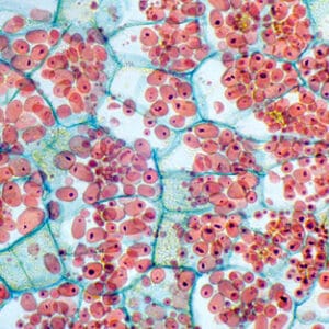 TUBERCULO DE SOLANUM TUBEROSUM (PATATA), SEC. Marca Zuzi.