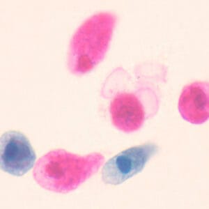 AMOEBA PROTEUS, M.E. Marca Zuzi.