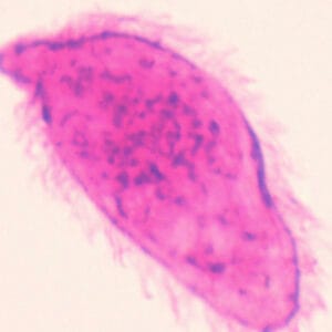 MIRACIDIO DE SCHISTOSOMA, M.E. Marca Zuzi.