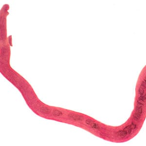SCHISTOSOMA HEMBRA, M.E. Marca Zuzi.
