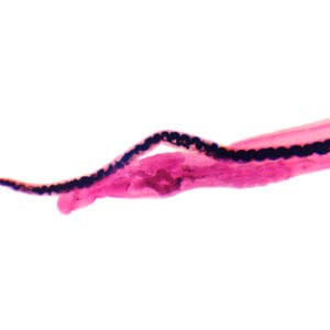 CONJUGACION DE SCHISTOSOMA MACHO Y HEMBRA, M.E. Marca Zuzi.