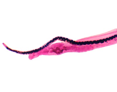 CONJUGACION DE SCHISTOSOMA MACHO Y HEMBRA, M.E. Marca Zuzi.