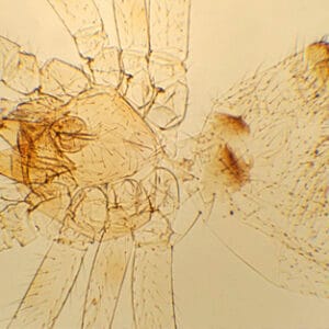 ARAÑA, M.E. Marca Zuzi.