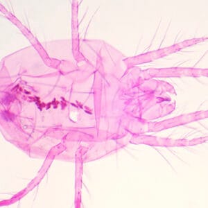 TETRANYCHUS TELARIUS (ARAÑUELA ROJA), M.E. Marca Zuzi.