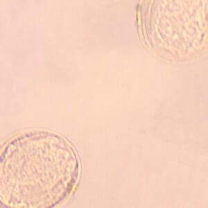 HUEVO DE SCHISTOSOMA, M.E. Marca Zuzi.