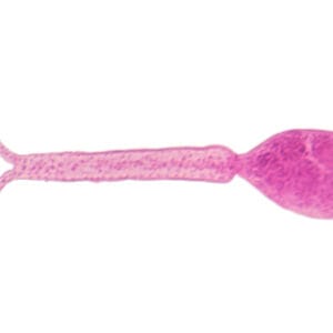 CERCARIA DE SCHISTOSOMA, M.E. Marca Zuzi.